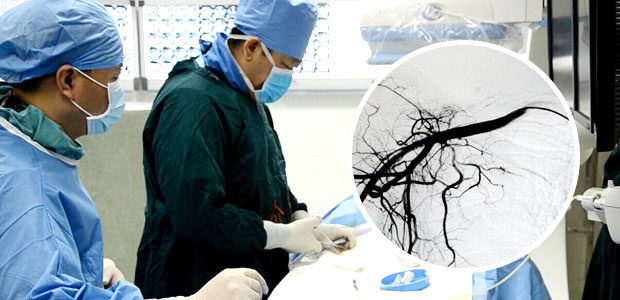 肺癌,微创治疗,肺癌治疗,介入疗法